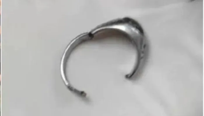 Dua Jam Penuh Kehati-hatian, Damkar Dumai Berhasil Lepas Cincin yang Melingkar di Kelamin Warga
